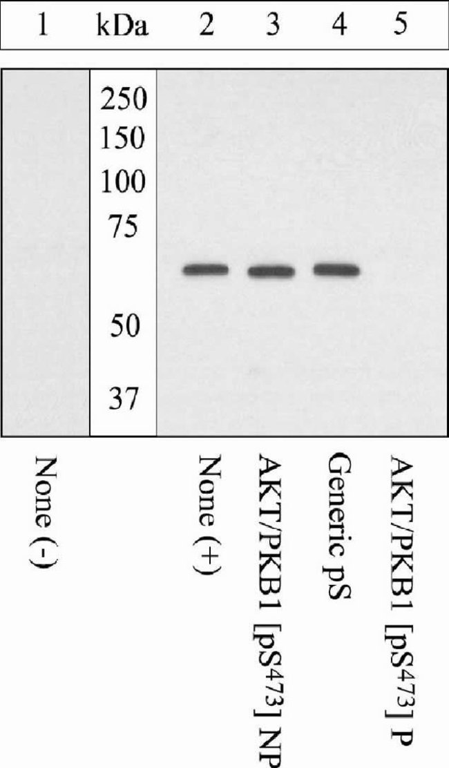 AKT/PKB1 [PS473] PAB GLYC 100 UL BIOSOUR