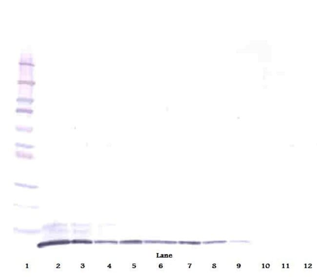 100UG ANTI-HUMAN GRO-BETA (CXCL2)