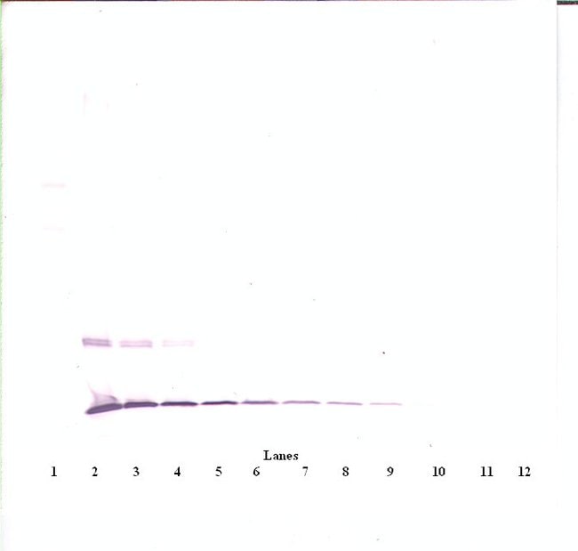 100UG ANTI-MURINE JE/MCP-1 (CCL2)