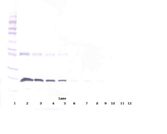 100UG ANTI-HUM 4-1BB RECEPTOR