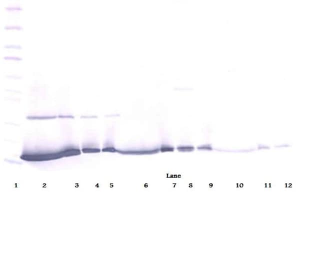 100UG ANTI-HUM IFN-GAMMA PEPROTECH