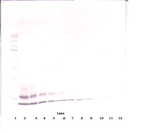 100UG ANTI-HUMAN MIP-1BETA (CCL4)