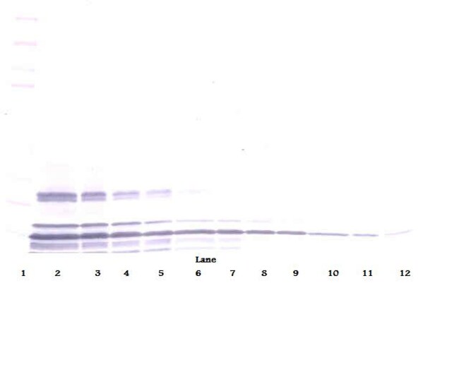 100UG ANTI-HUM LYMPHOTACTIN (XCL1)