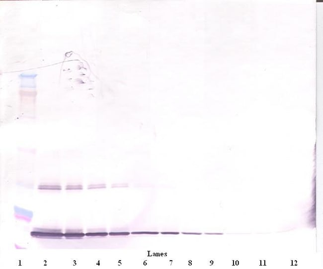 100UG ANTI-HUMAN G-CSF PEPROTECH