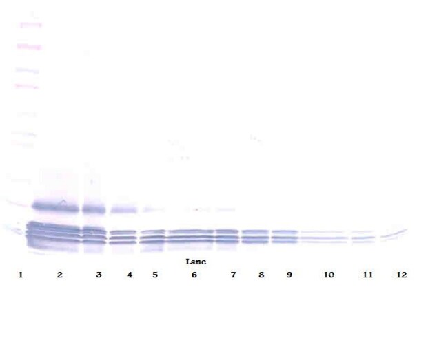 100UG ANTI-MURINE EOTAXIN (CCL11)