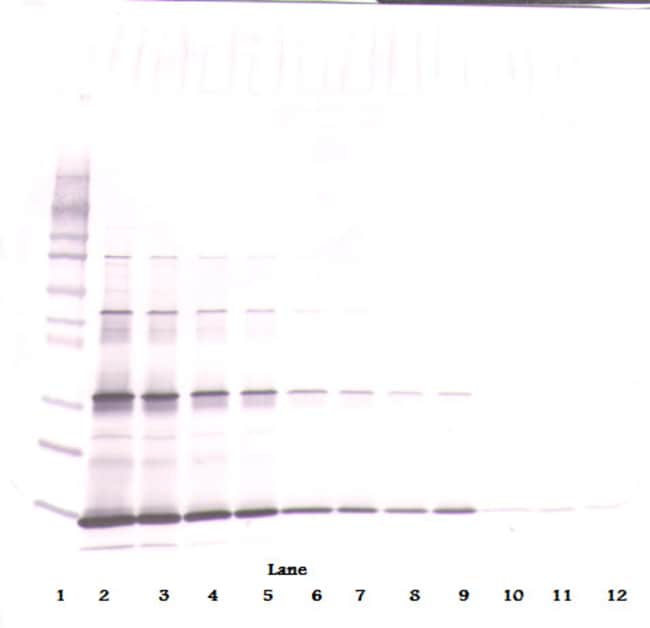 100UG ANTI-HUMAN LEPTIN PEPROTECH