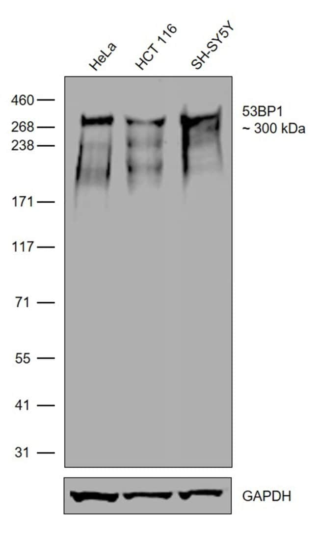 100UG 53BP17H14L12MONOANTIBODY 100UG