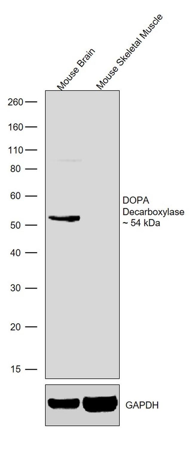 100UG AADC/DDC1H21L22MONOANTIBODY 100UG