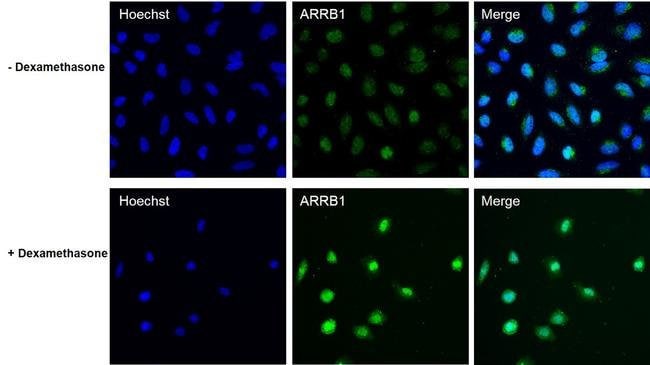 100UG ARRB1 ANTIBODY 100 UG