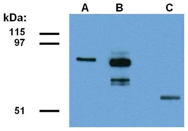 Anti-ABRA1 Monoclonal Antibody (ABRA1-01