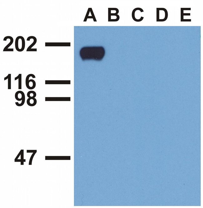 Anti-EGFR (Phospho-Tyr992) Monoclonal