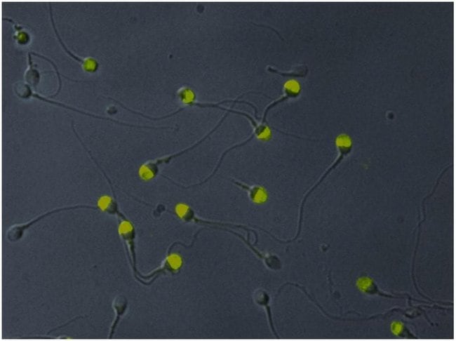 Anti-Intra-Acrosomal Protein Monoclonal