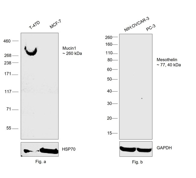 Anti-Kappa light chains Monoclonal