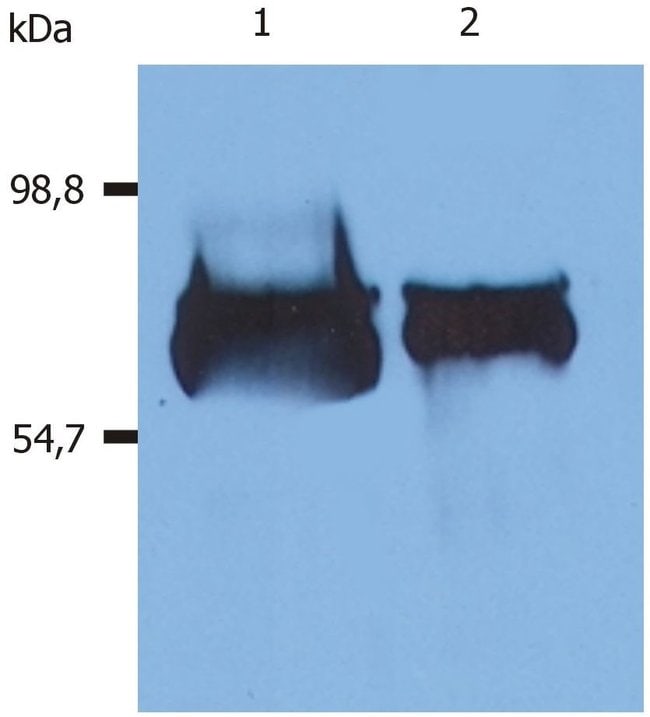 ALBUMIN