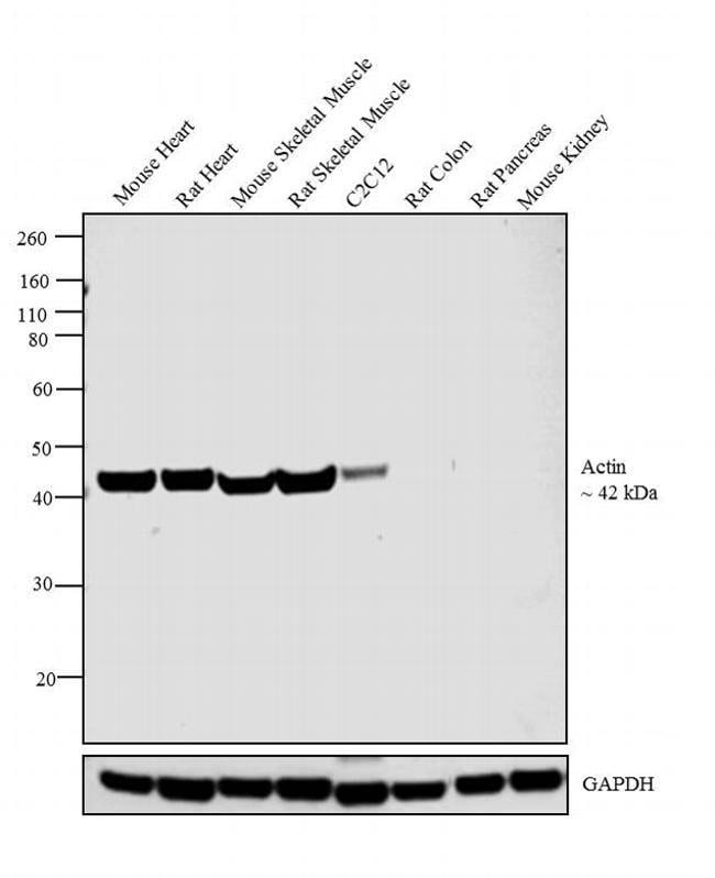 Anti-Actin Monoclonal Antibody (HHF35),