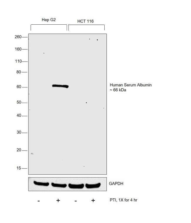 ALBUMIN