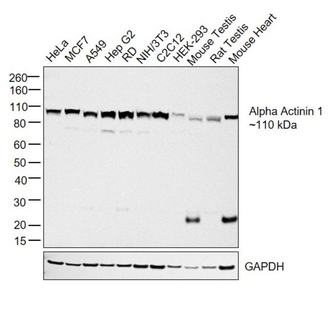 ALPHA ACTININ