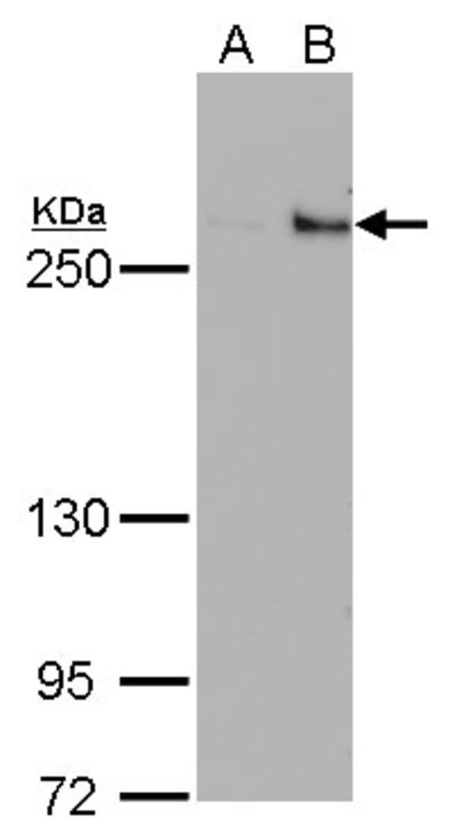 ANTI-TET1