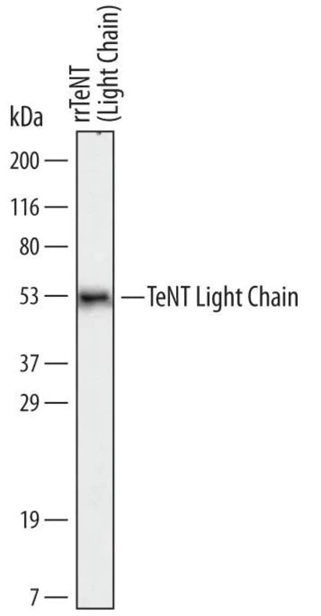 100UG C.TETANI TENT LIGHT CHAIN