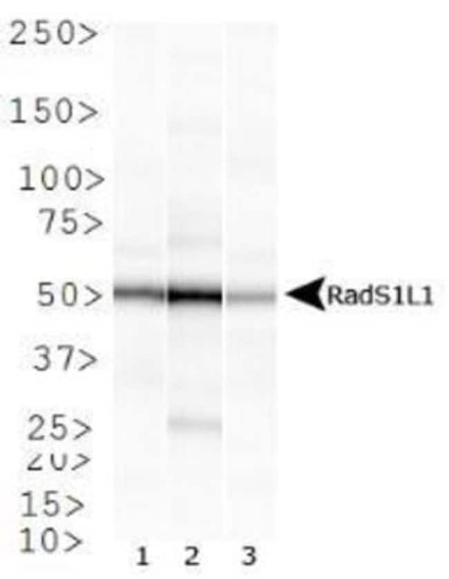 0.1ML RAD51B 0.1 ML