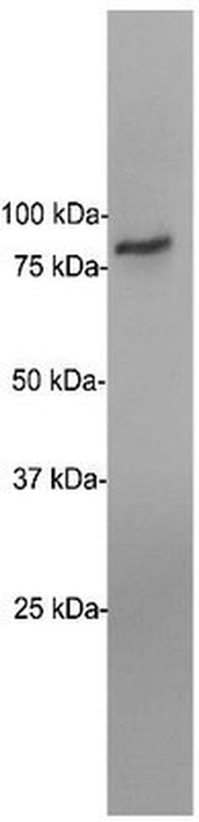 0.1ML EWSR1 0.1 ML