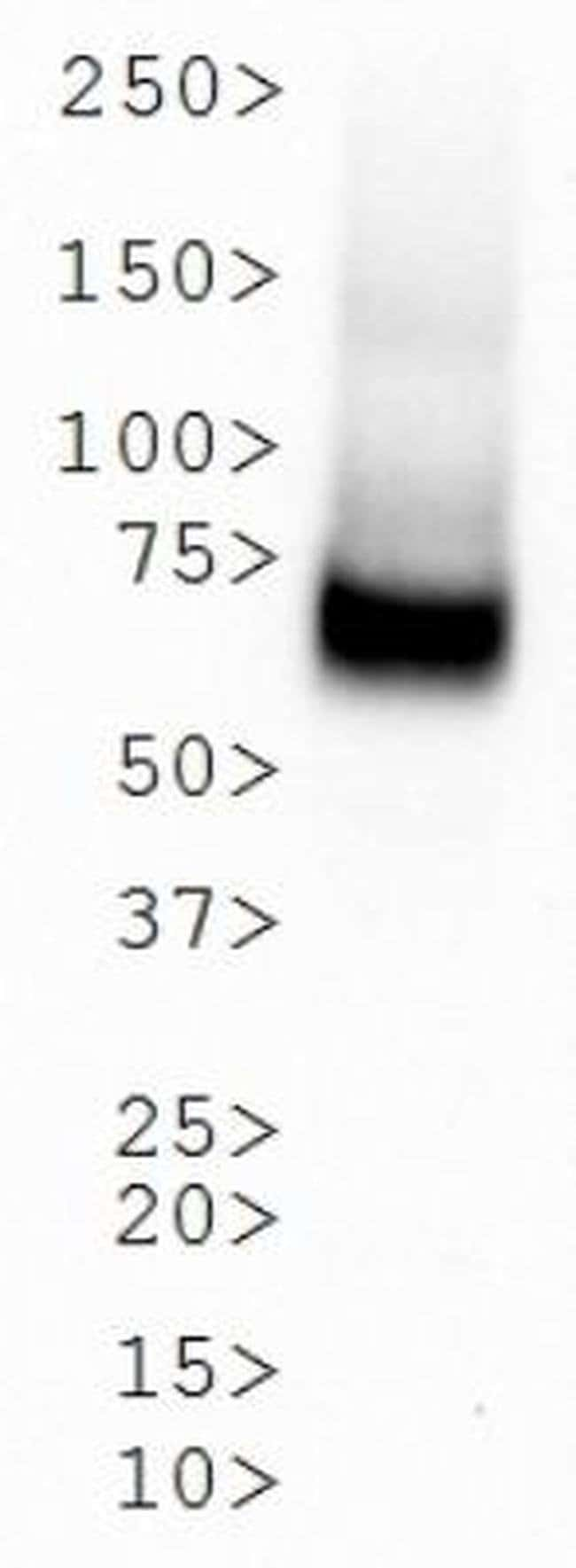 0.1ML DOPAMINE TRANSPORTER 0.1 ML