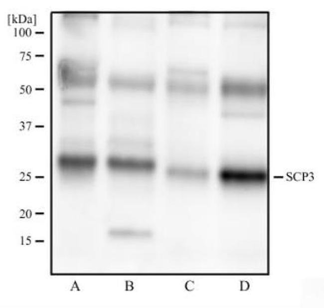 0.1ML CTDSPL 0.1 ML