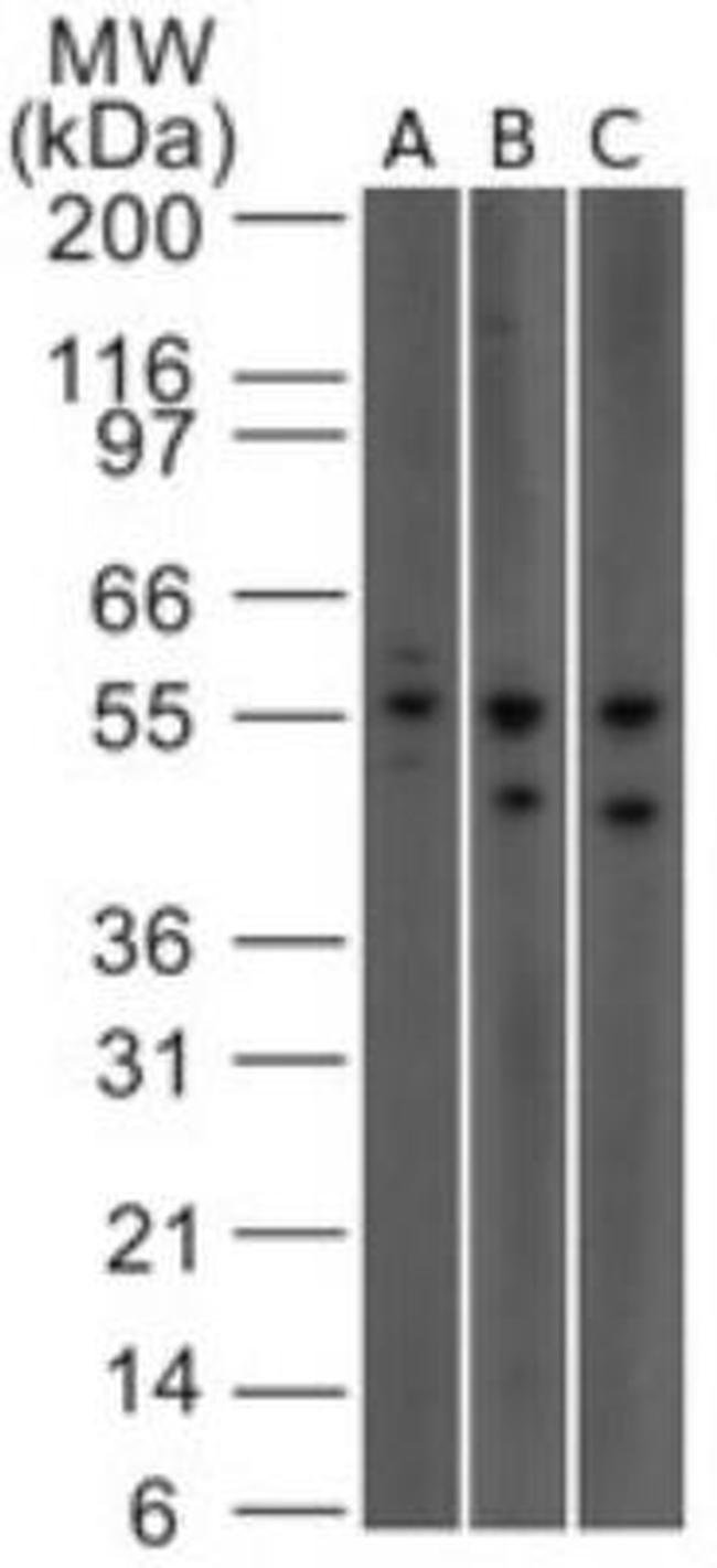 0.1MG IL23R 0.1 MG