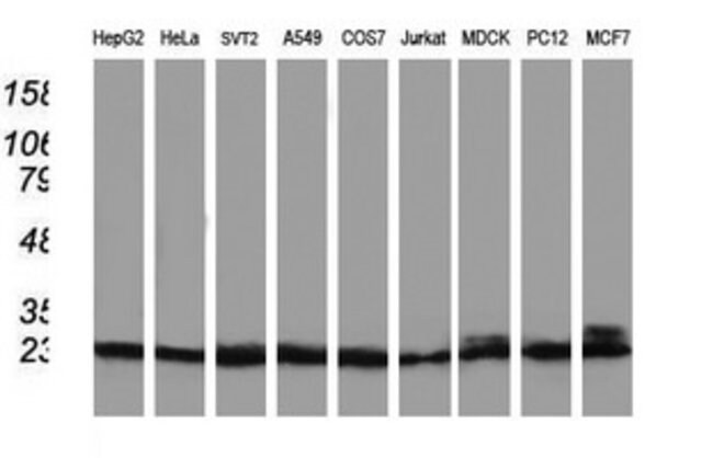 100 UL Primary Antibodies