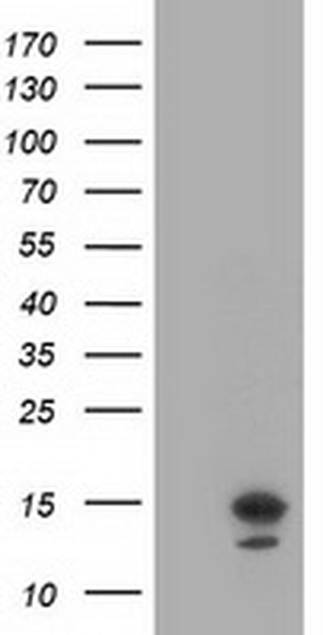 100 L LSM1 Monoclonal Antibody (OTI9D7)