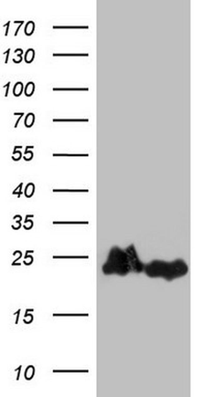 100 UL eIF1AY Monoclonal Antibody