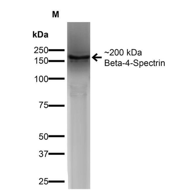 100UG BETA 4 SPECTRIN 100 UG