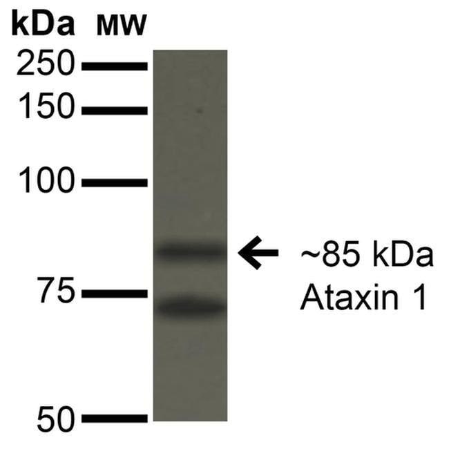 100UG Ataxin 1 Monoclonal Antibody (S76-