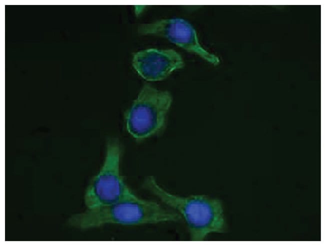 0.2ML CYTOKERATIN 19 1.0 ML