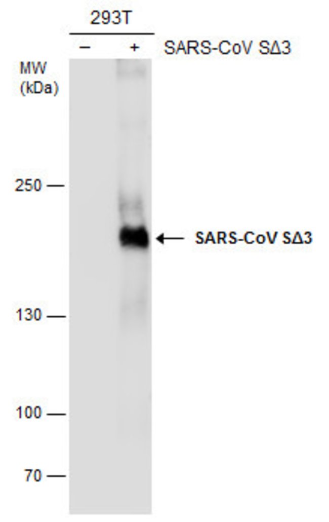 100 UL SARS-CoV Spike Protein (SDelta3)