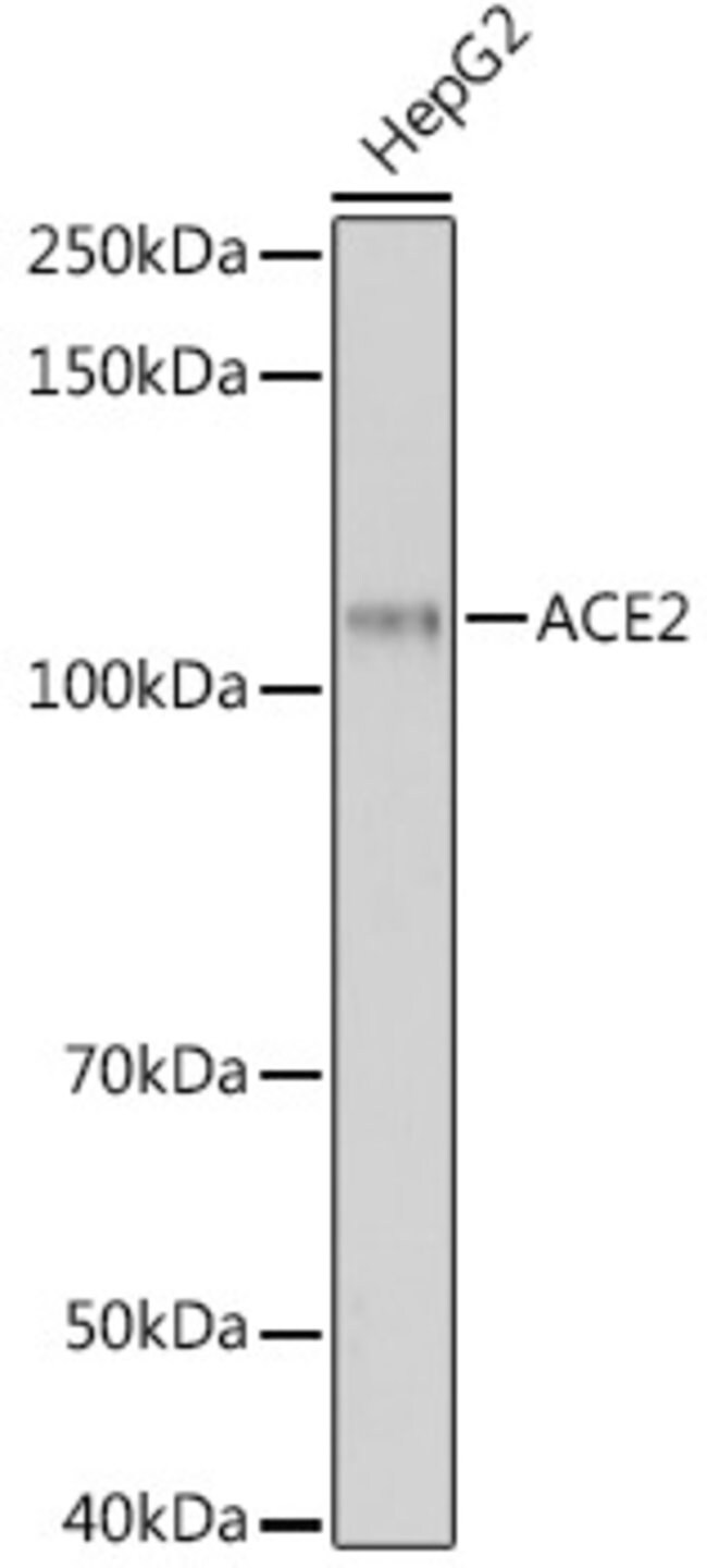 100UG ACE2 ANTIBODY 100 UL