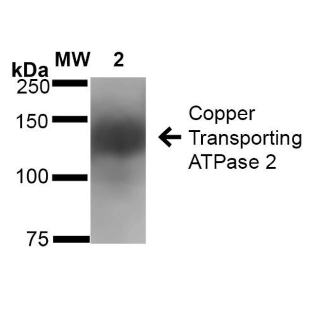 100UG ATP7B ANTIBODY APC 100 UG