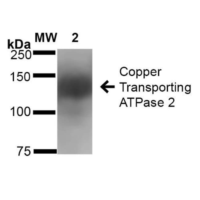 100UG ATP7B ANTIBODY FITC 100 UG