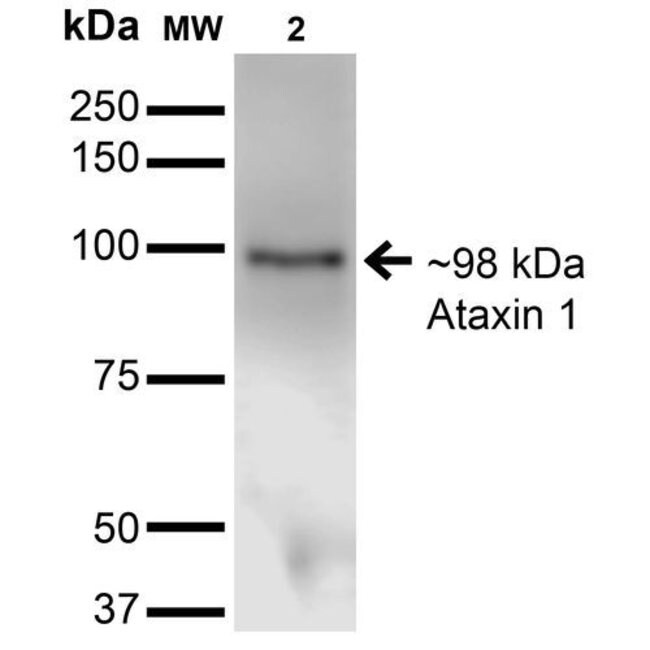 100UG ATAXIN 1 ANTIBODY APC 100 UG