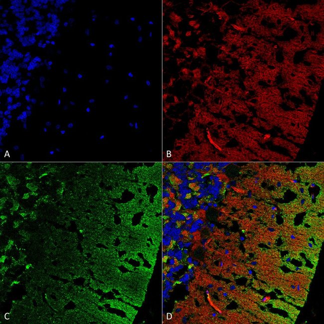 100UG ALPHA SYNUCLEIN ANTIBODY FITC 100