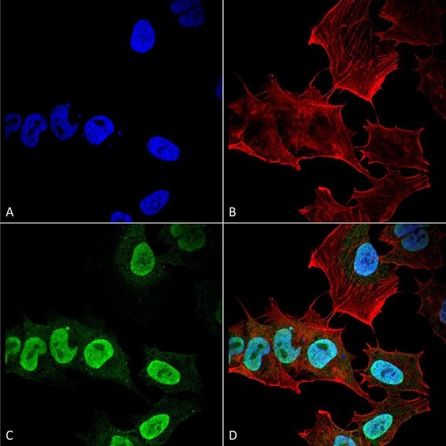 100UG ALPHA SYNUCLEIN ANTIBODY PERCP 100