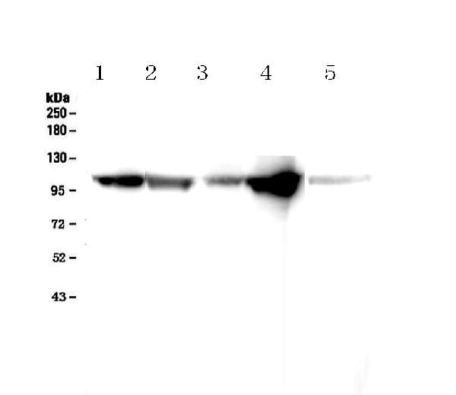 100UG ALPHA ACTININ 2 MAB 100 UG