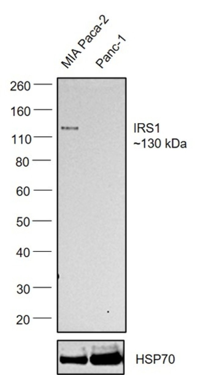 100UL IRS-1