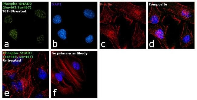 100UL PHOSPHO-SMAD2 (SER465/467)