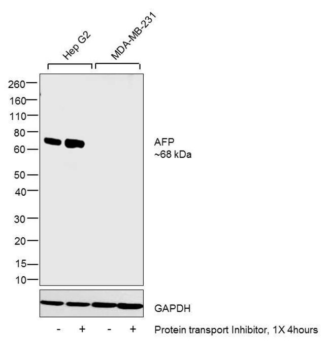 Alpha Fetoprotein Monoclonal Antibody (F