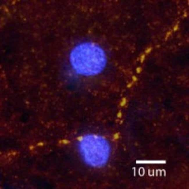 ALPHA 2A ADRENERGIC RECEPTOR