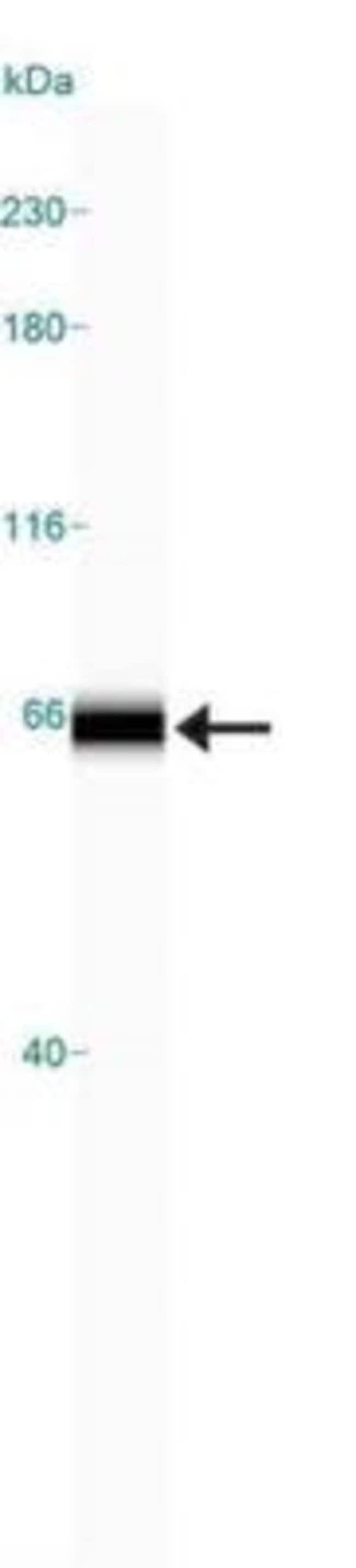 AMINOLEVULINATE DELTA-SYNTHASE 1