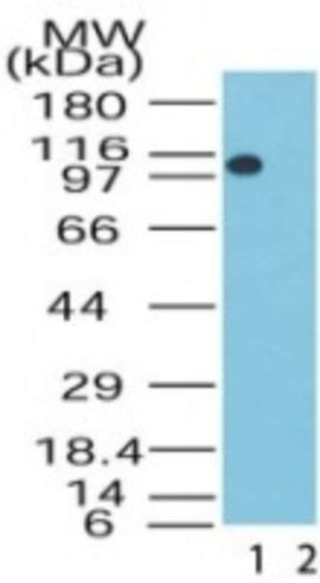 AMINE OXIDASE DOMAIN 2