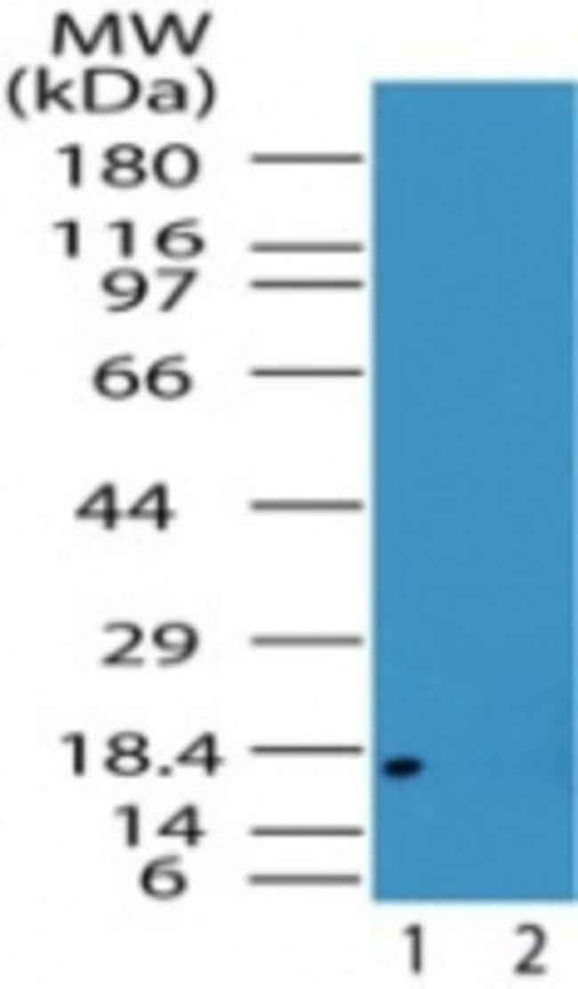 ACID PHOSPHATASE 1 (ISOFORM B)