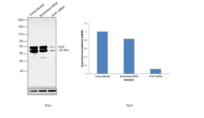 ALPHA-1 ANTITRYPSIN